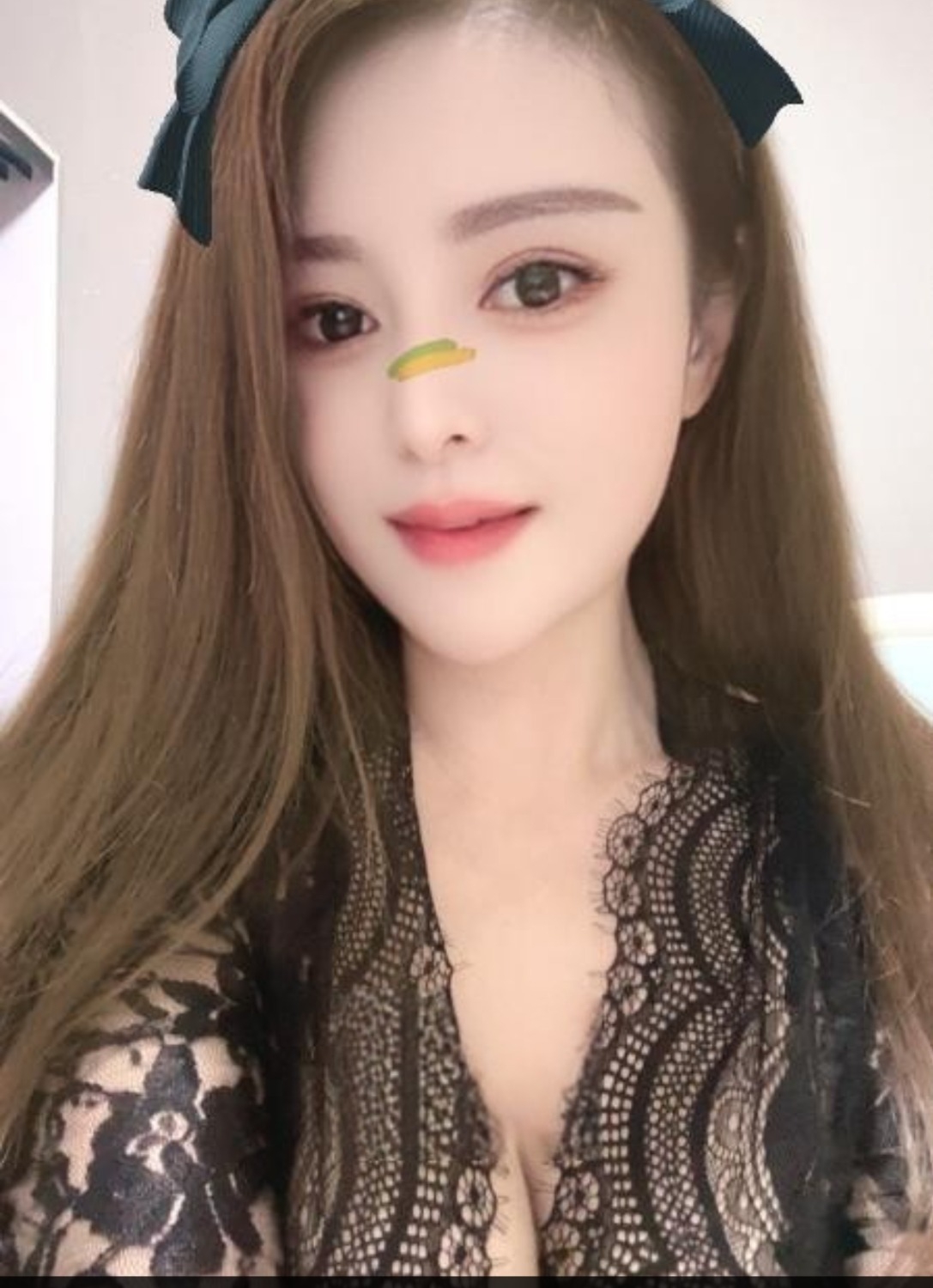 精彩照片